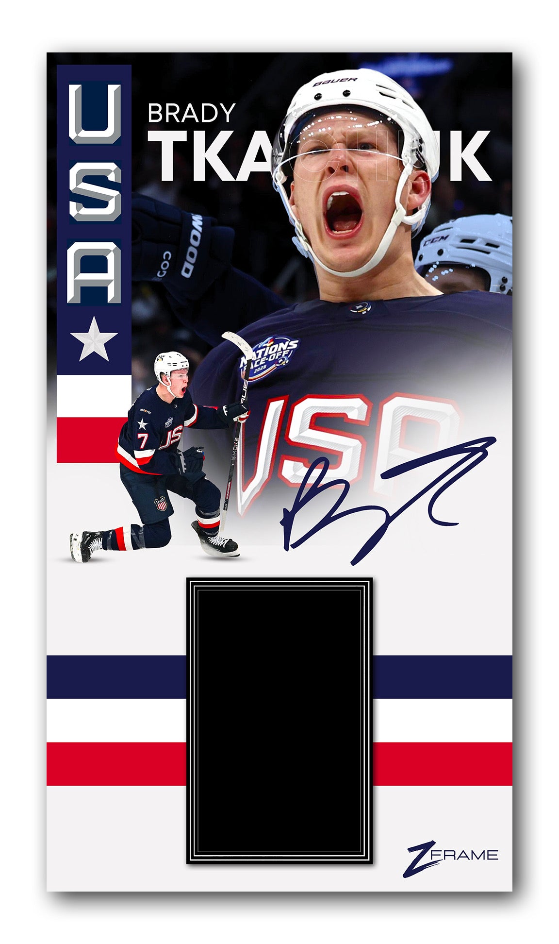 ZFrame - Brady Tkachuk